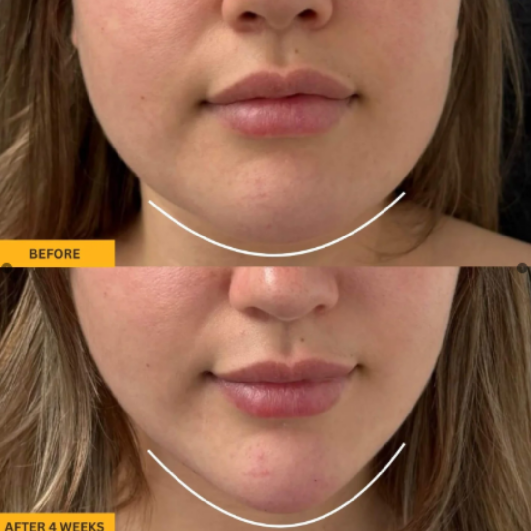 GUA SHA BRUSH FOR SNATCHED FACE