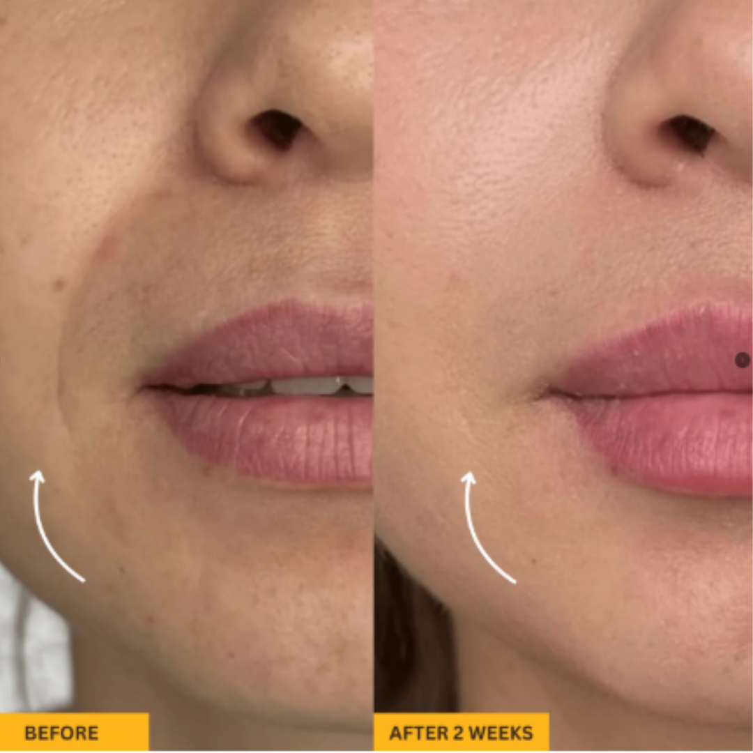 GUA SHA BRUSH FOR SNATCHED FACE